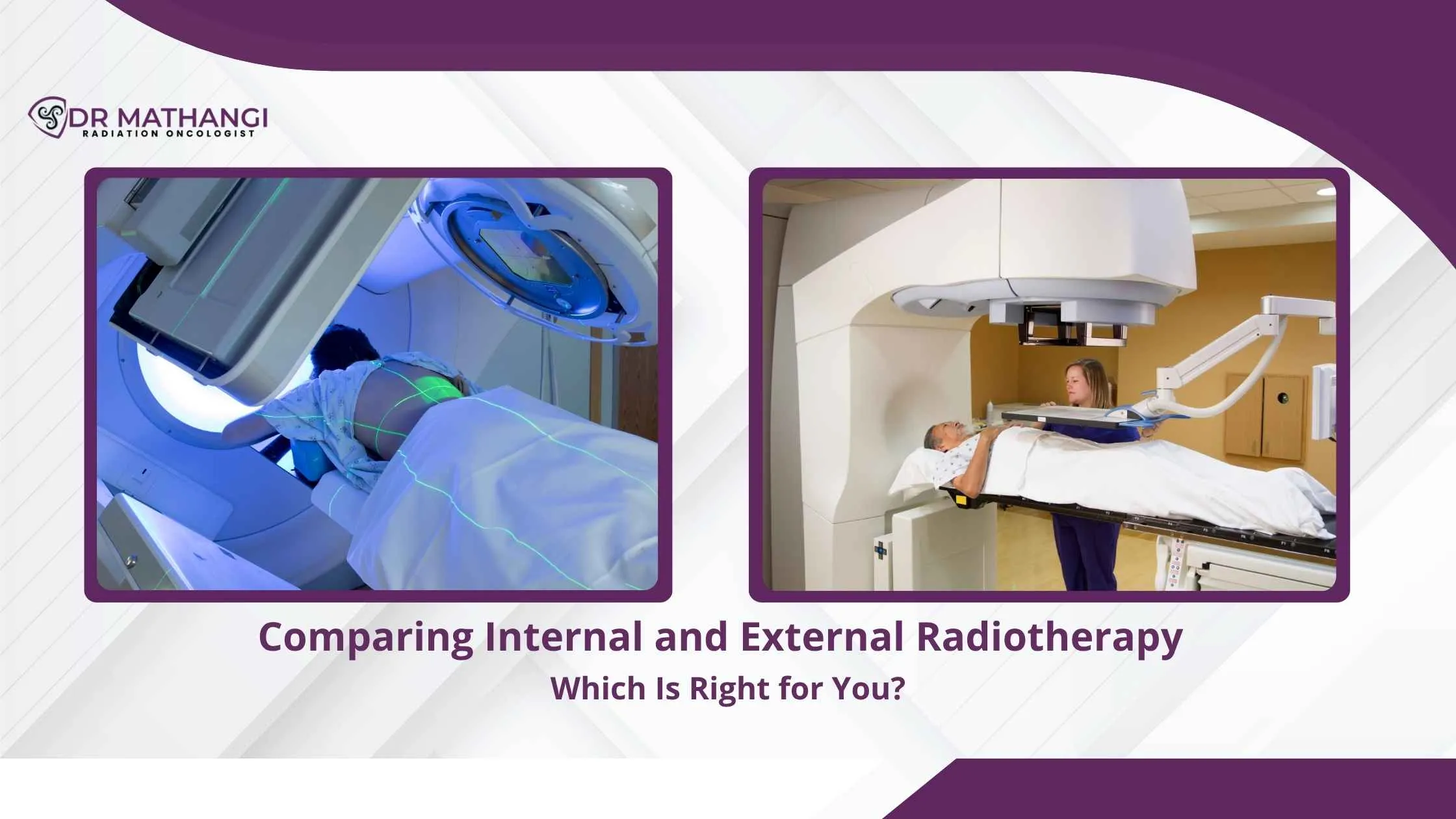 Radiotherapy