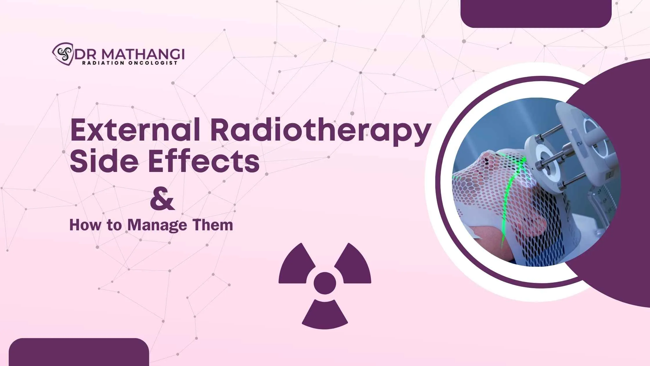 External radiotherapy