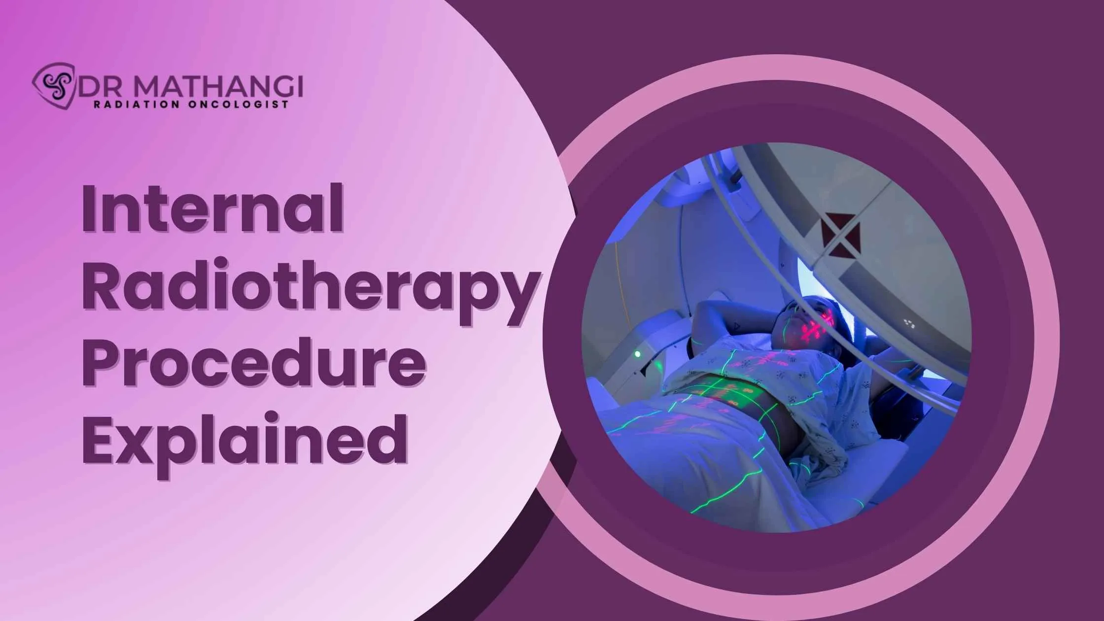 Internal radiotherapy Procedure